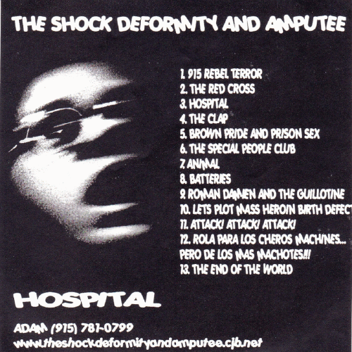 The Shock Deformity And Amputee : Hospital